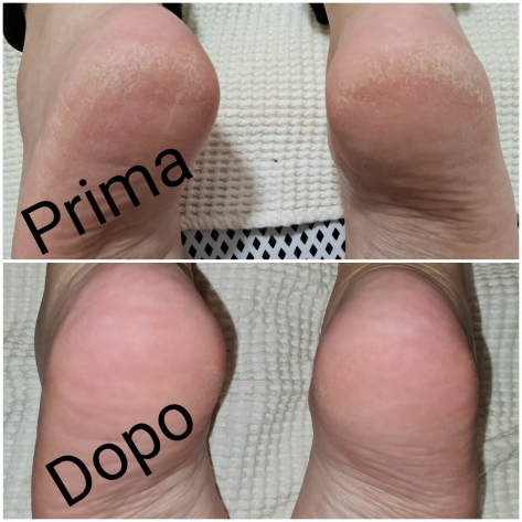 Pedicure a secco_(6)